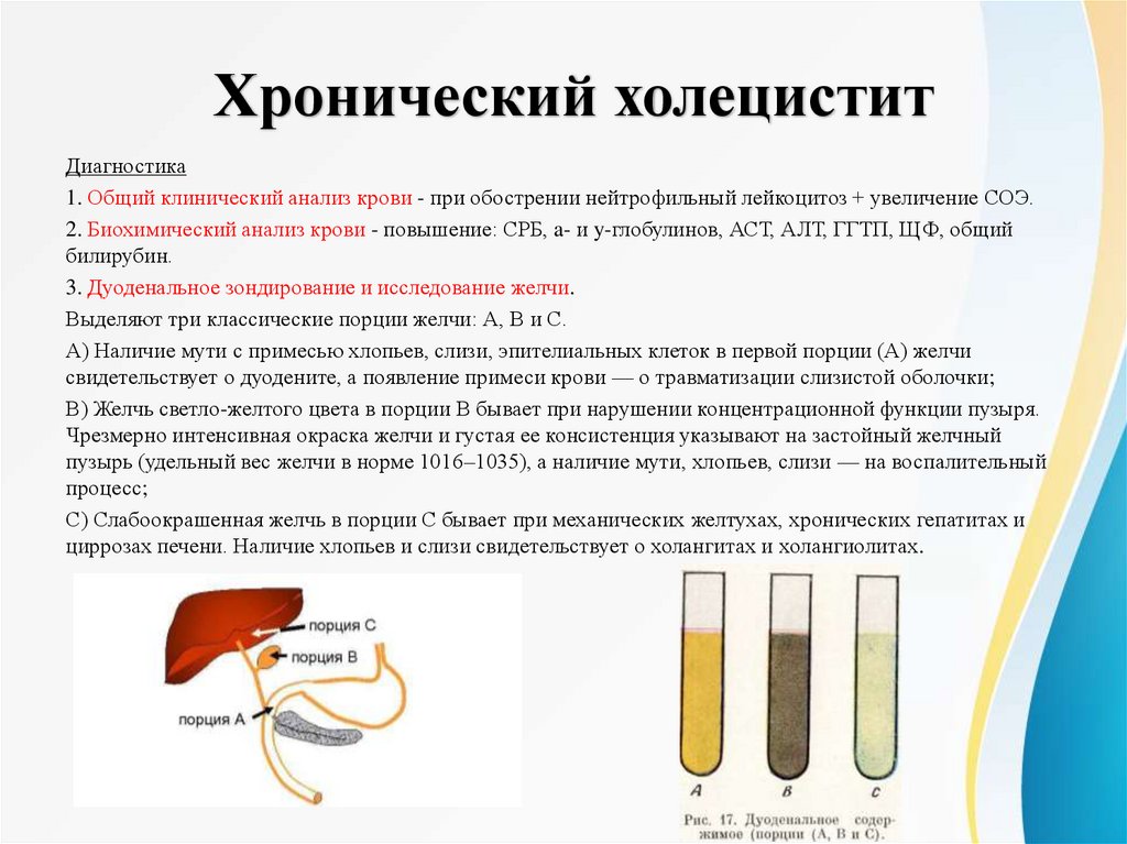 Хронический холецистит