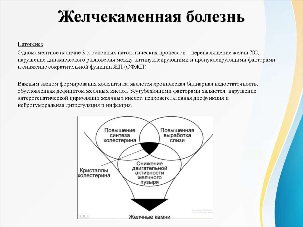 Желчекаменная болезнь