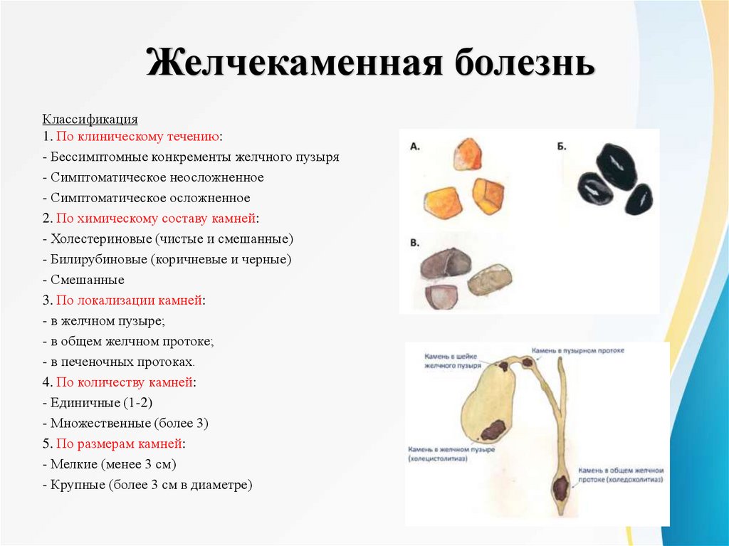 Желчекаменная болезнь