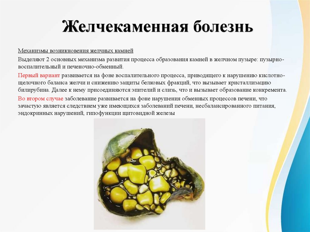 Желчекаменная болезнь