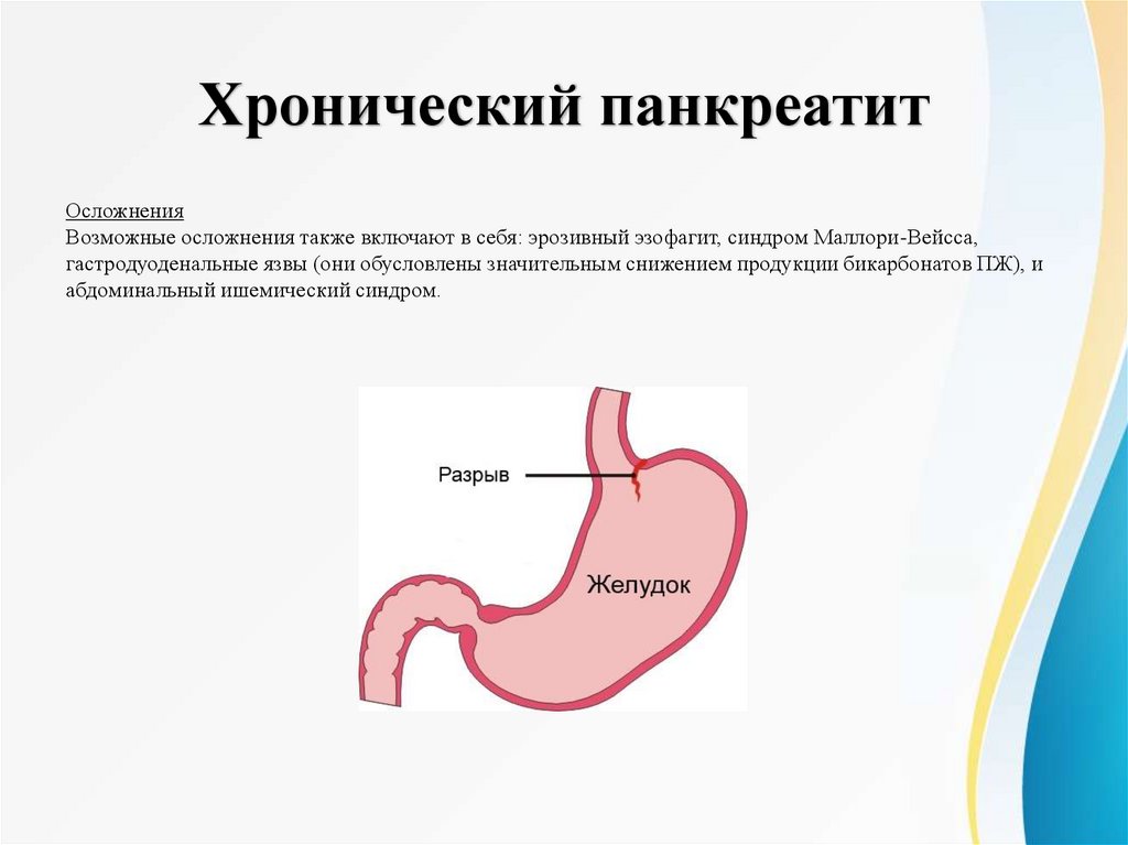 Хронический панкреатит