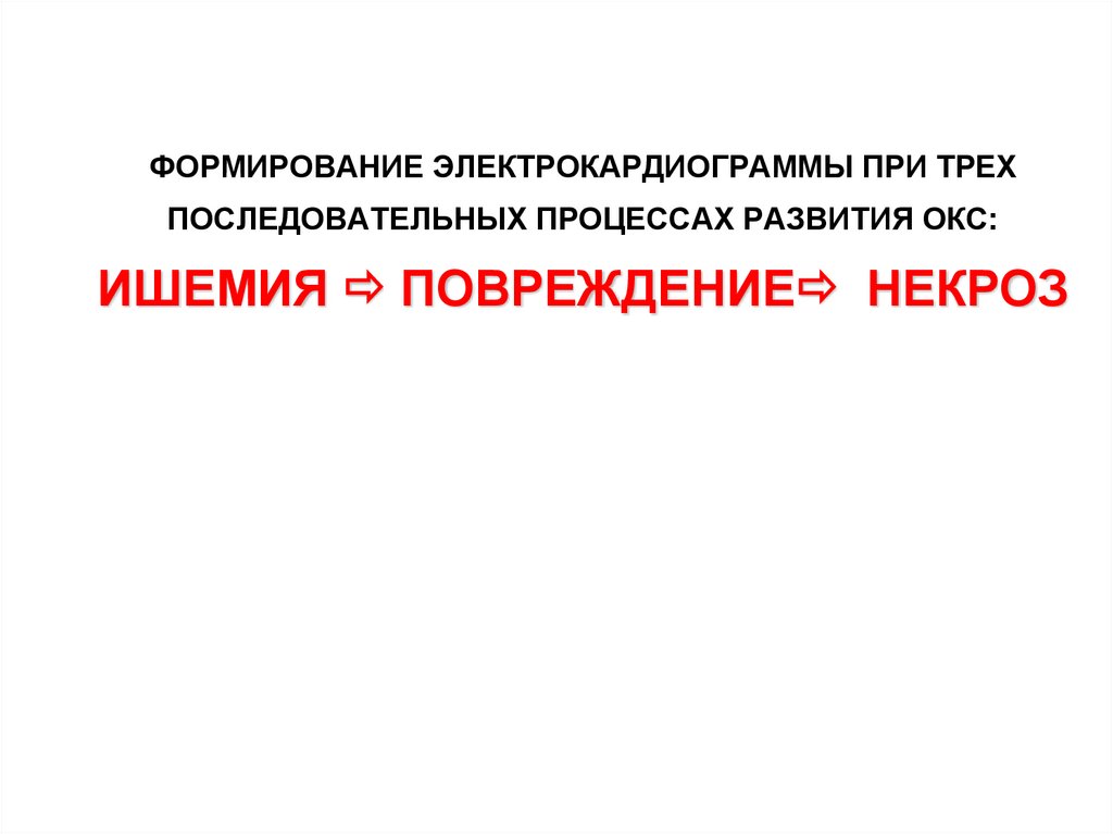 ФОРМИРОВАНИЕ ЭЛЕКТРОКАРДИОГРАММЫ ПРИ ТРЕХ ПОСЛЕДОВАТЕЛЬНЫХ ПРОЦЕССАХ РАЗВИТИЯ ОКС: ИШЕМИЯ  ПОВРЕЖДЕНИЕ НЕКРОЗ