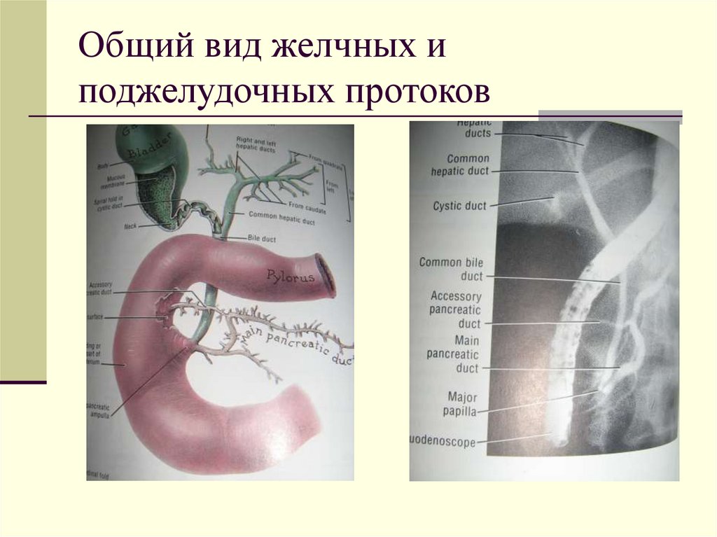 Общий вид желчных и поджелудочных протоков