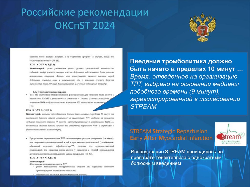 Российские рекомендации ОКСпST 2024