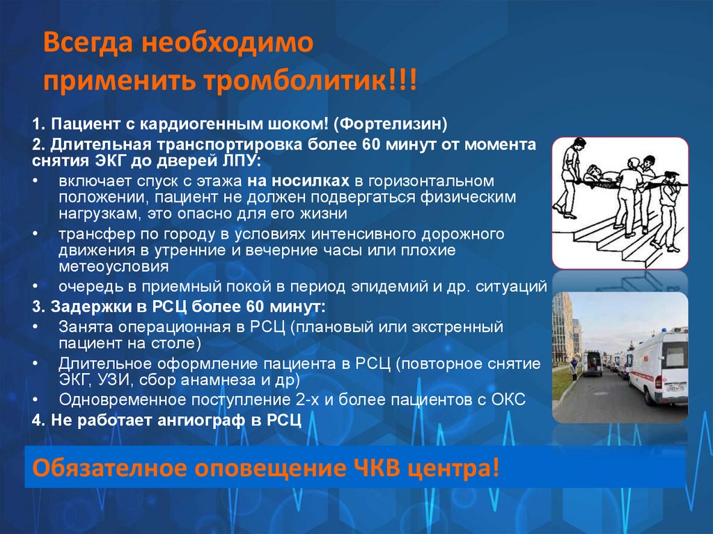 Всегда необходимо применить тромболитик!!!