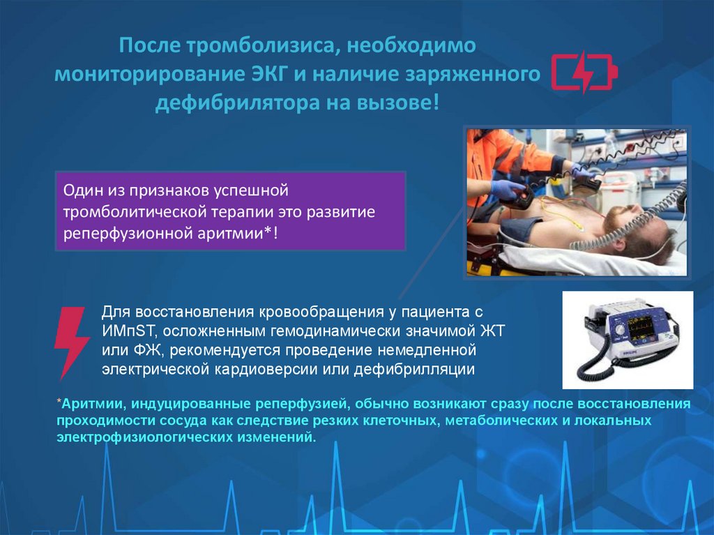 После тромболизиса, необходимо мониторирование ЭКГ и наличие заряженного дефибрилятора на вызове!