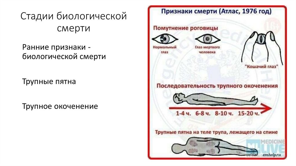 Стадии биологической смерти
