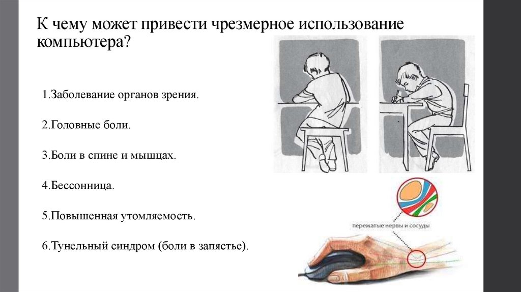 К чему может привести чрезмерное использование компьютера?