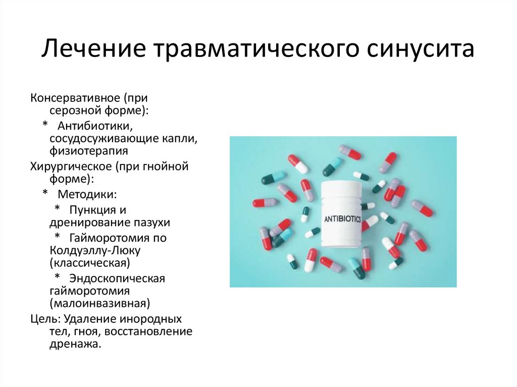 Лечение травматического синусита