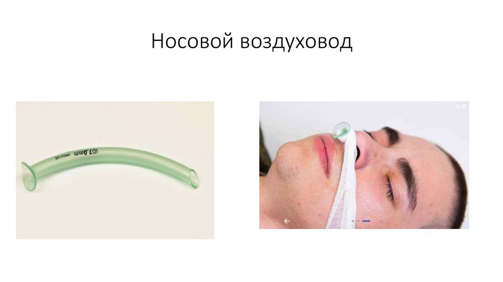 Носовой воздуховод