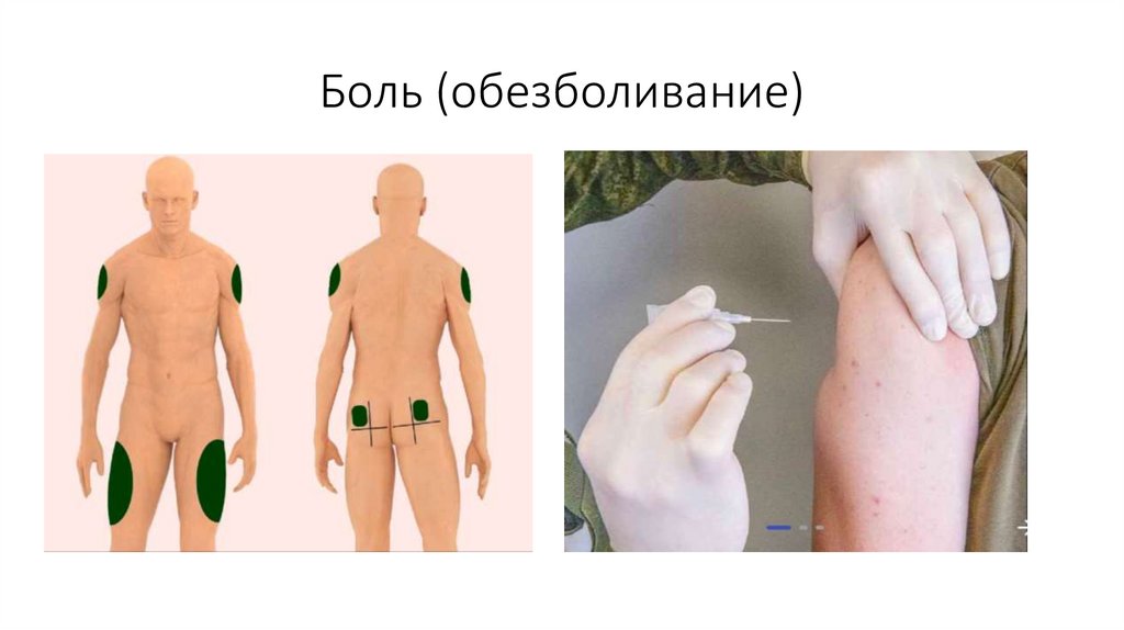 Боль (обезболивание)