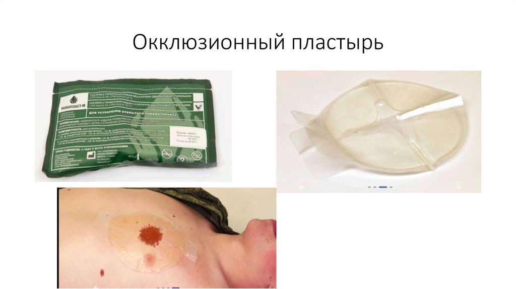 Окклюзионный пластырь