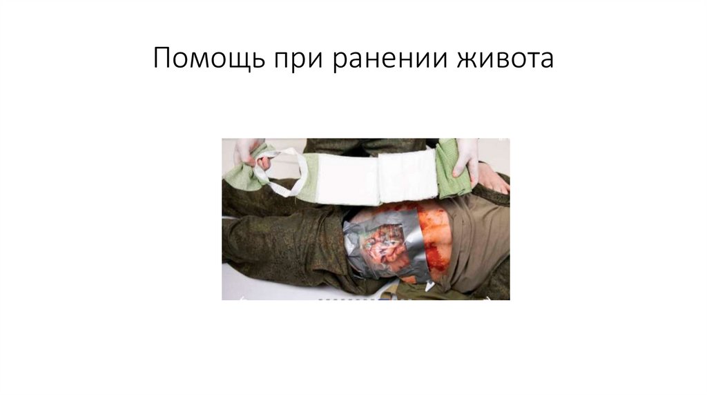 Помощь при ранении живота