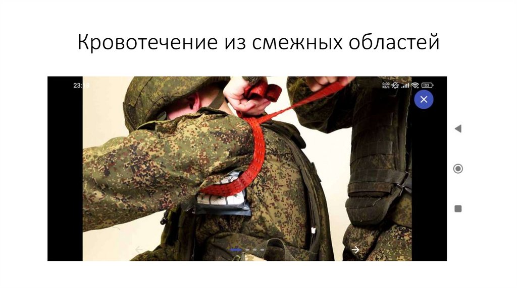 Кровотечение из смежных областей