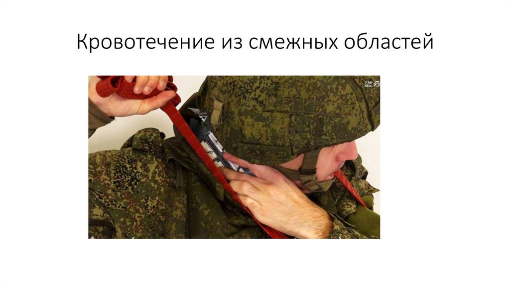 Кровотечение из смежных областей