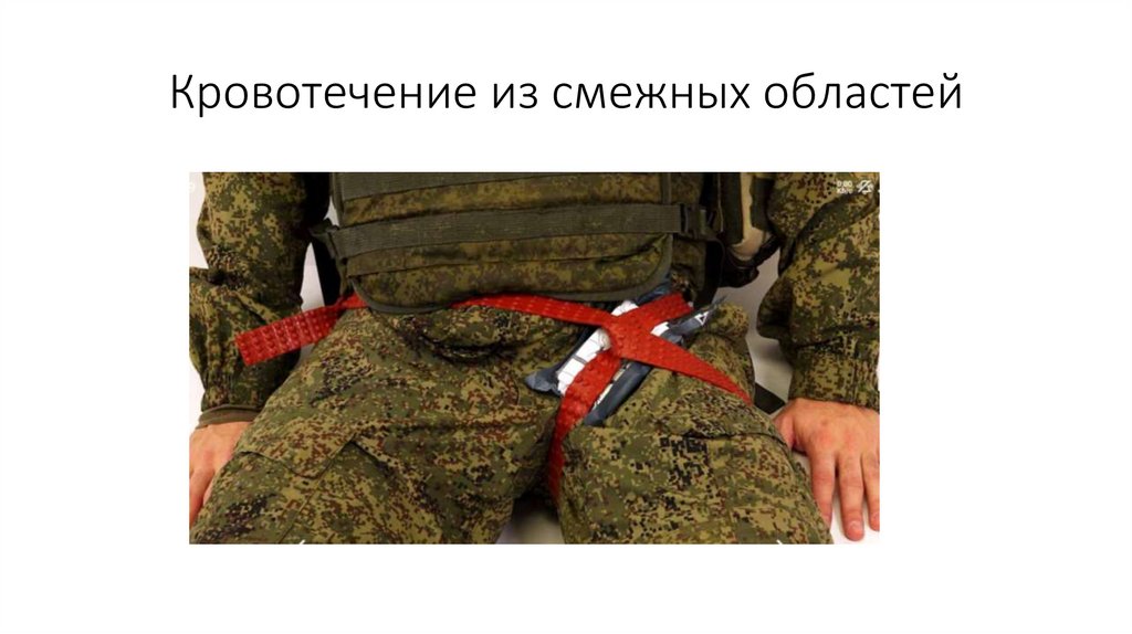 Кровотечение из смежных областей