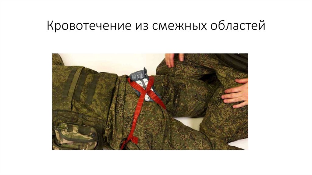 Кровотечение из смежных областей