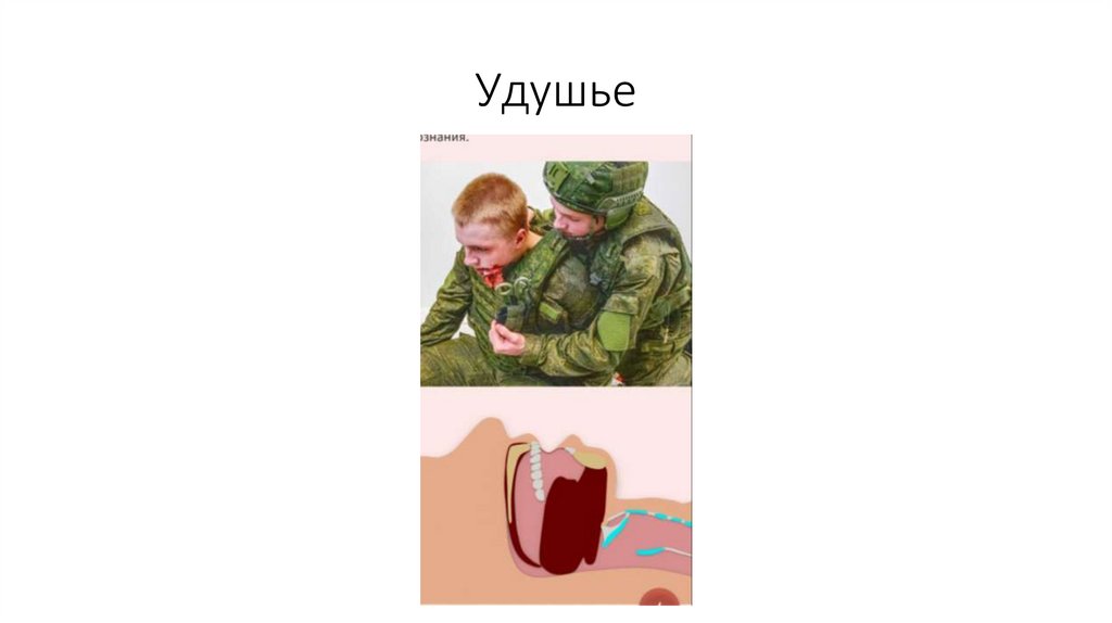 Удушье