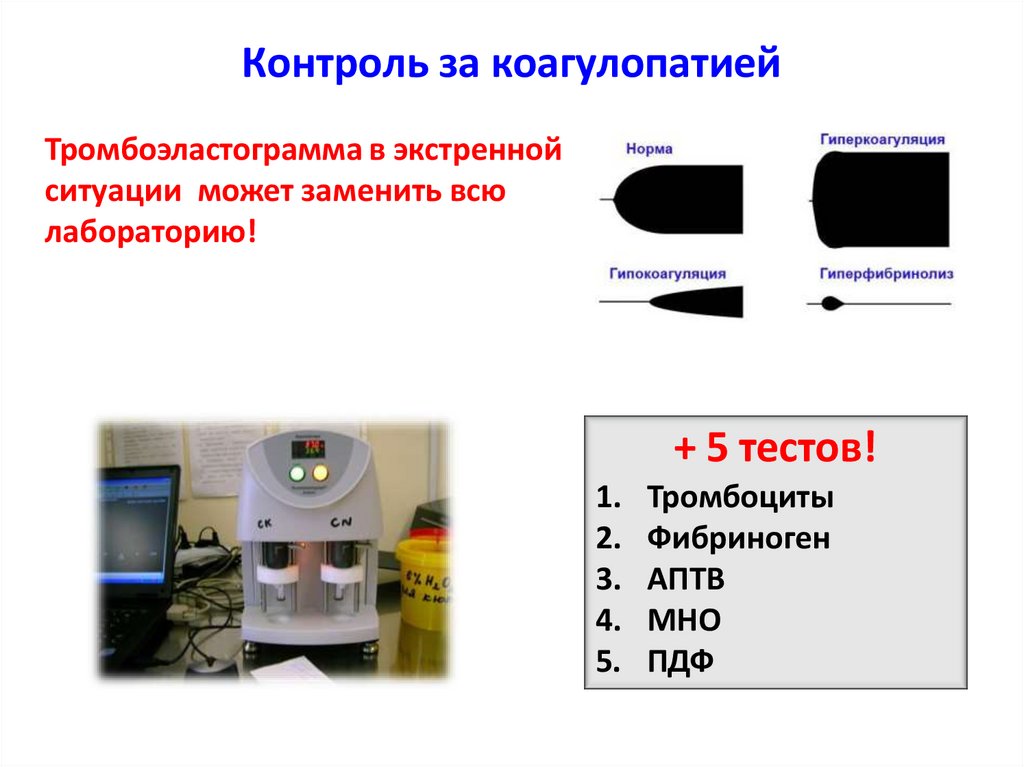 Контроль за коагулопатией