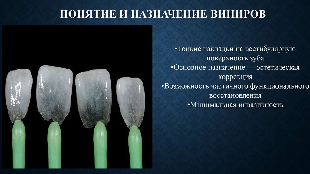 Понятие и назначение виниров