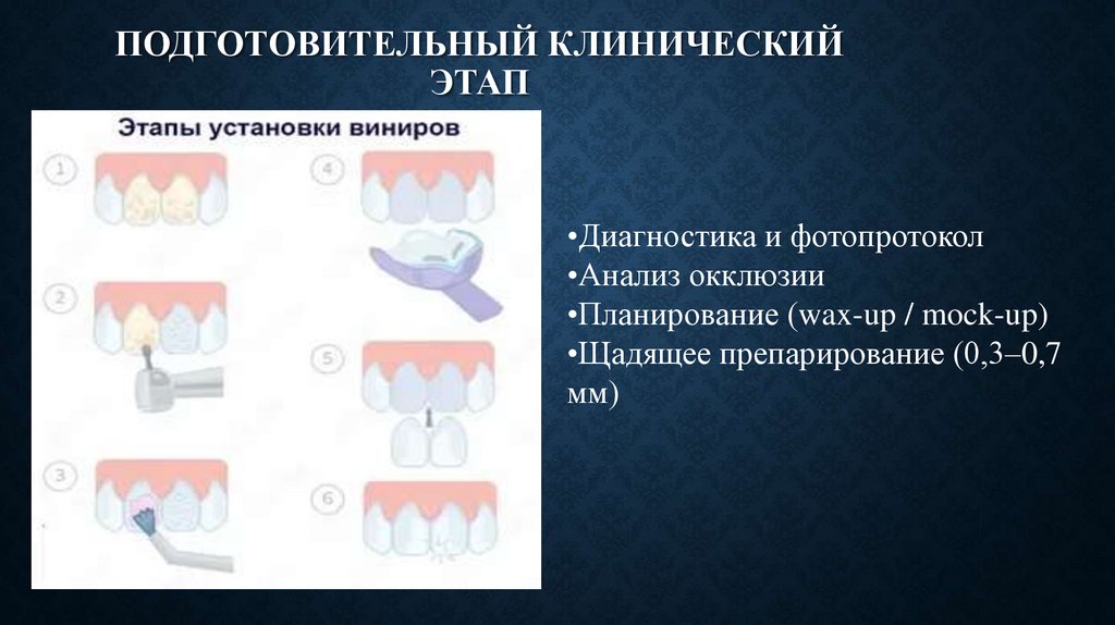 Подготовительный клинический этап