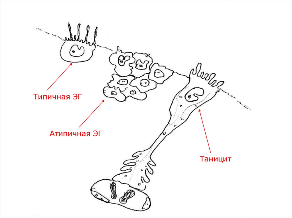 Эпендимоциты