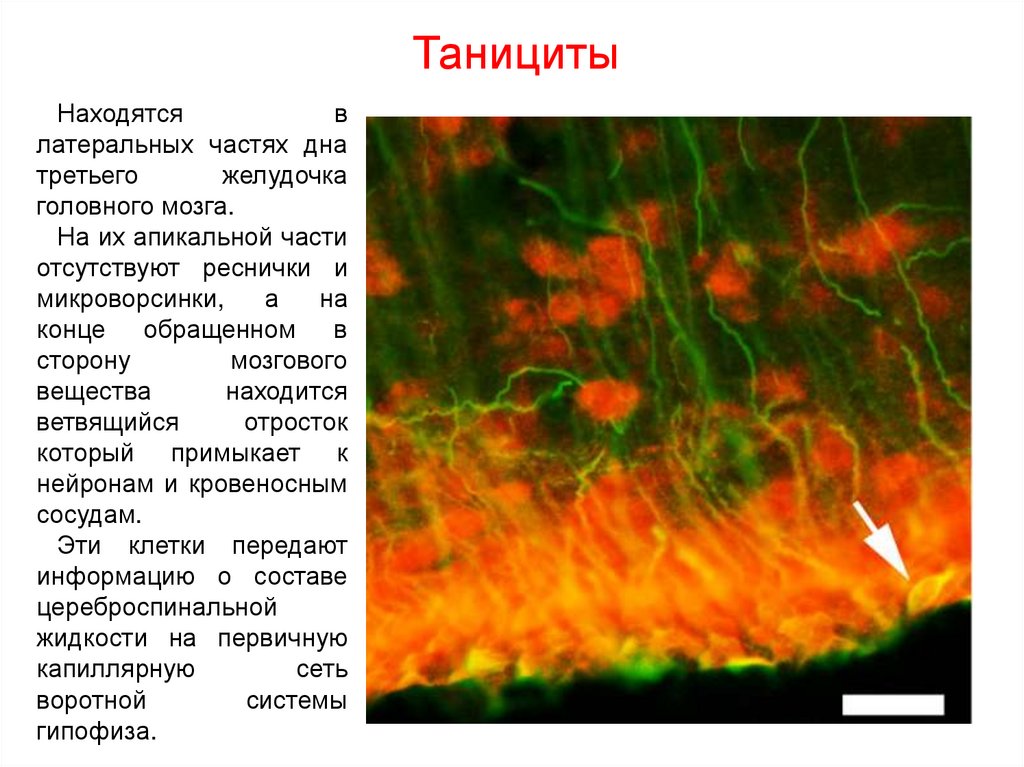 Типичная ЭГ