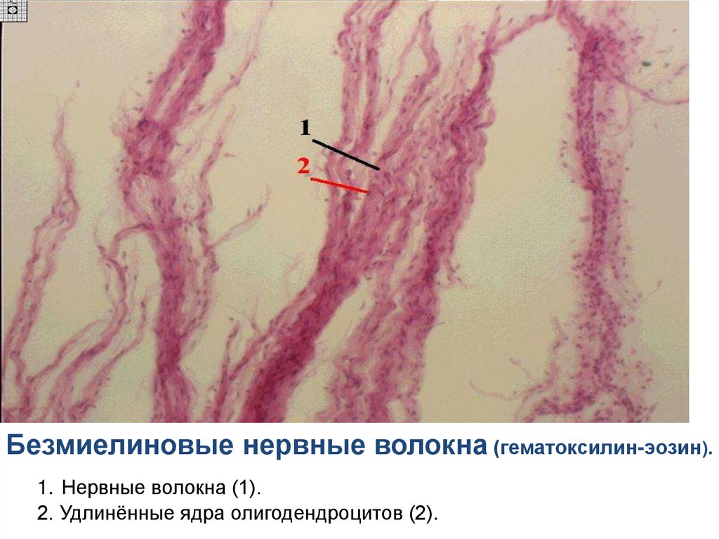 Безмиелиновые нервные волокна