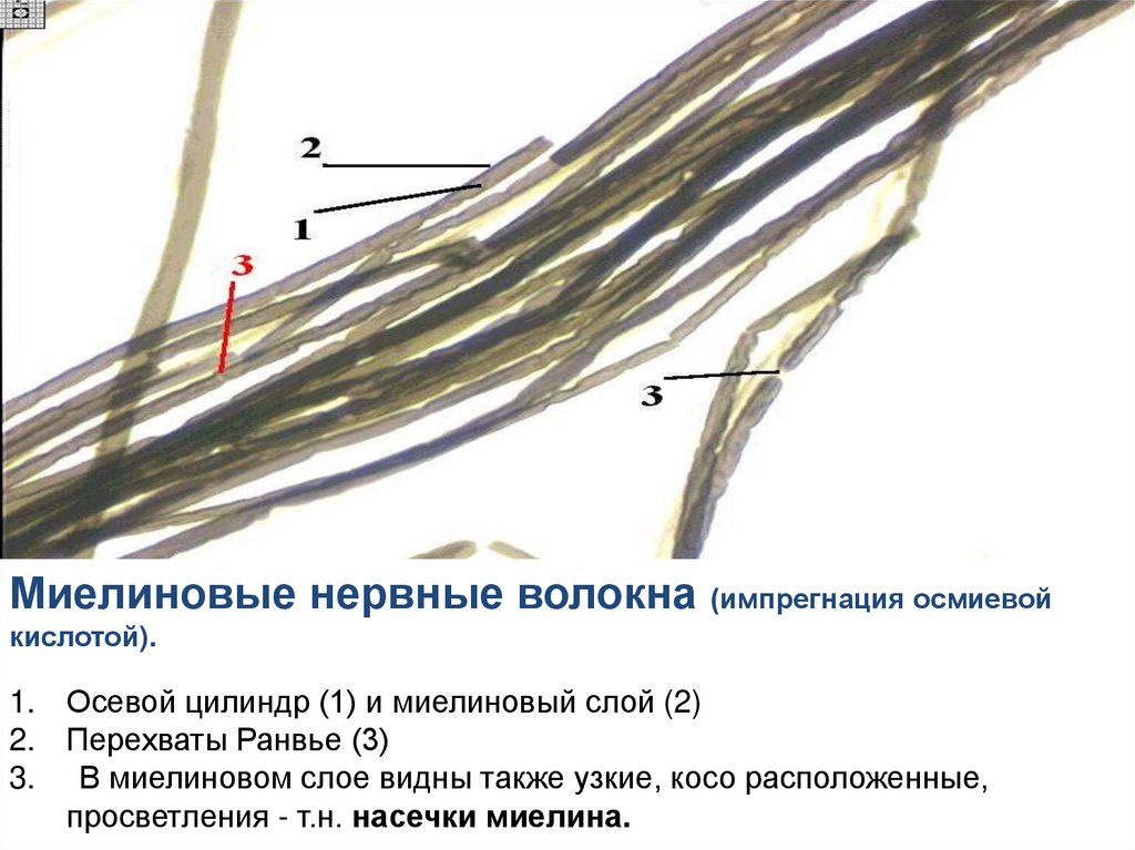 Миелиновые волокна