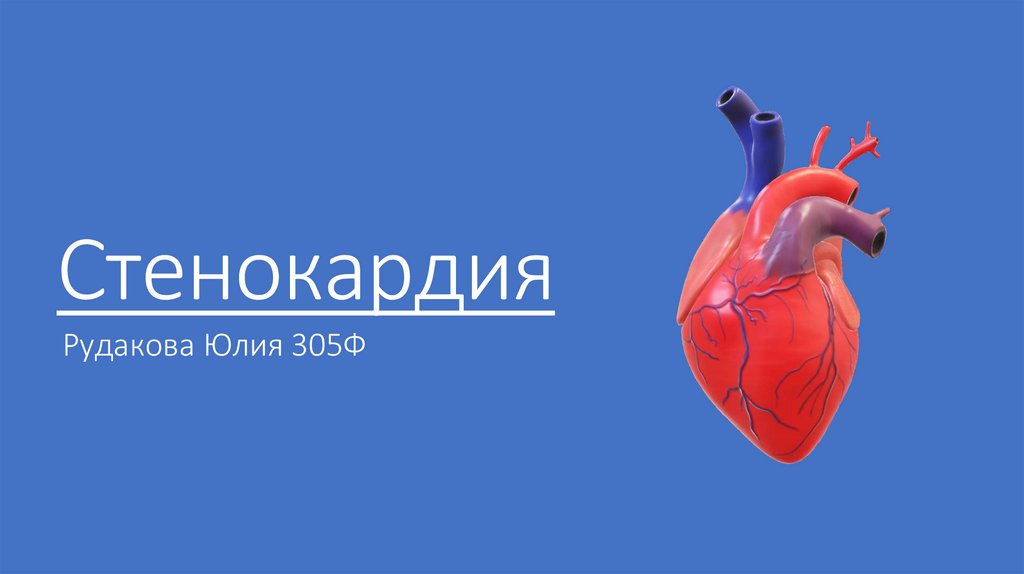 Стенокардия