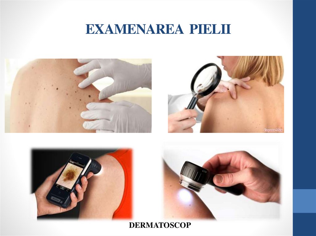 EXAMENAREA PIELII