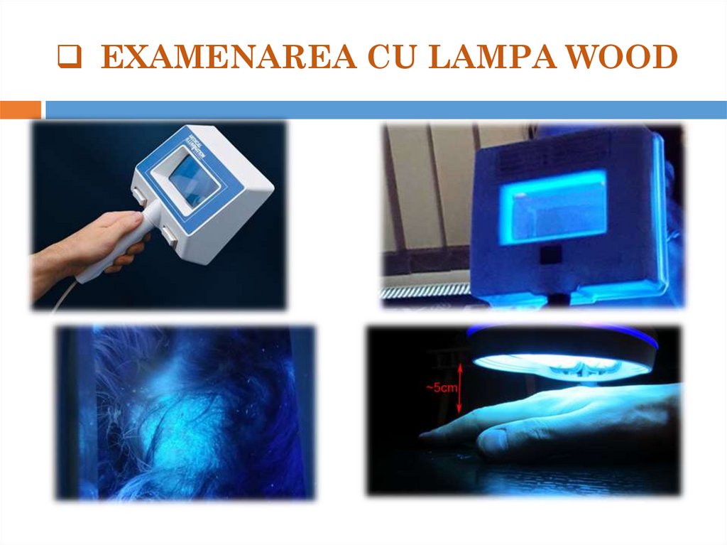 EXAMENAREA CU LAMPA WOOD