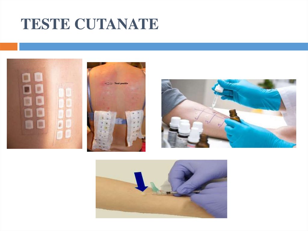 TESTE CUTANATE