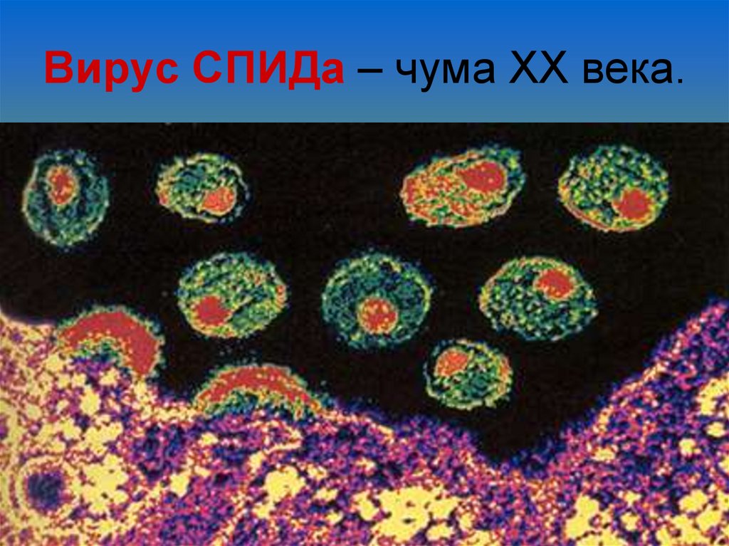 Вирус СПИДа – чума XX века.