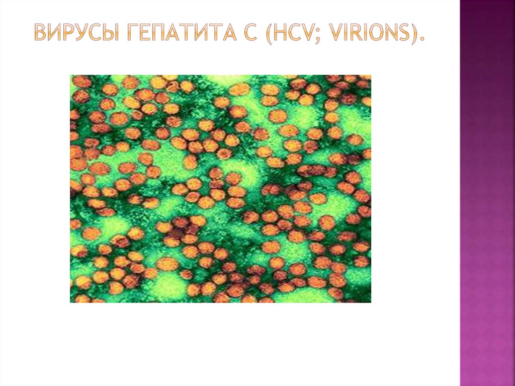 Вирусы Гепатита C (HCV; virions).