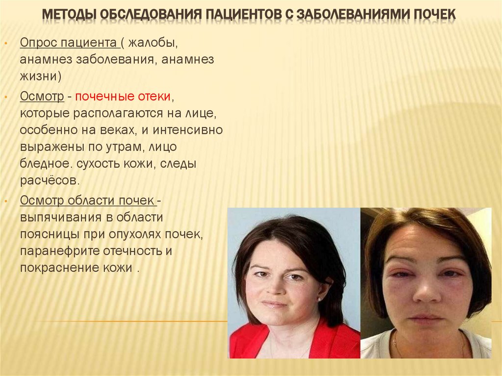 Методы обследования пациентов с заболеваниями почек