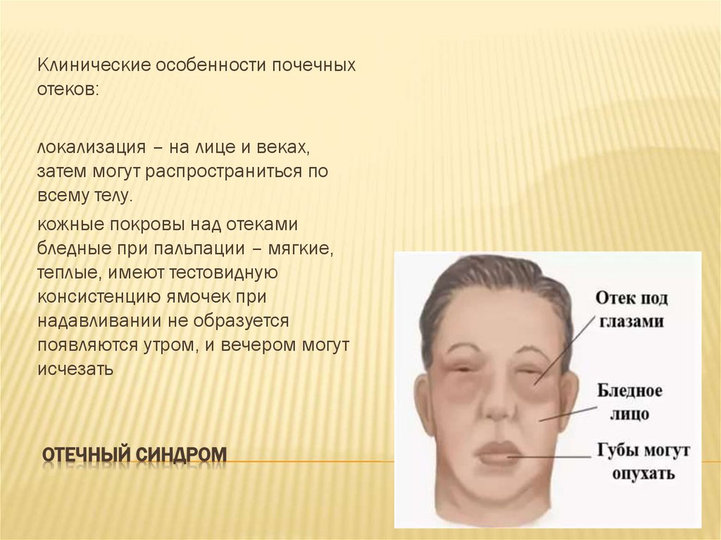 Отечный синдром