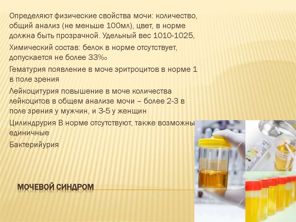 Мочевой синдром