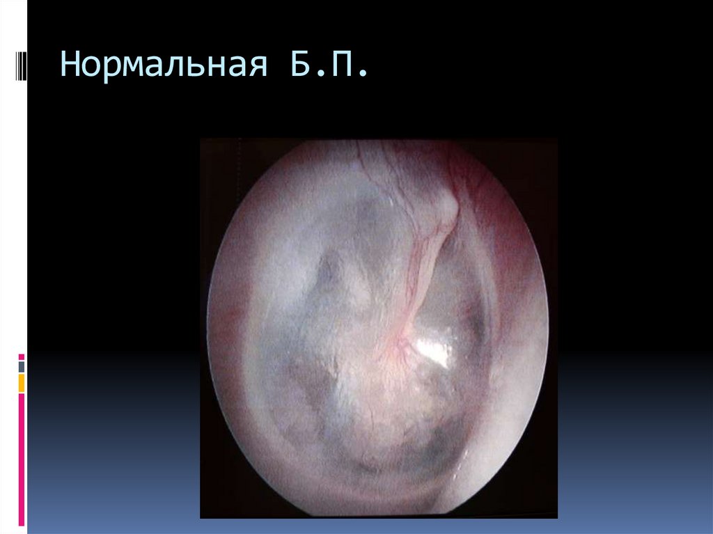 Нормальная Б.П.