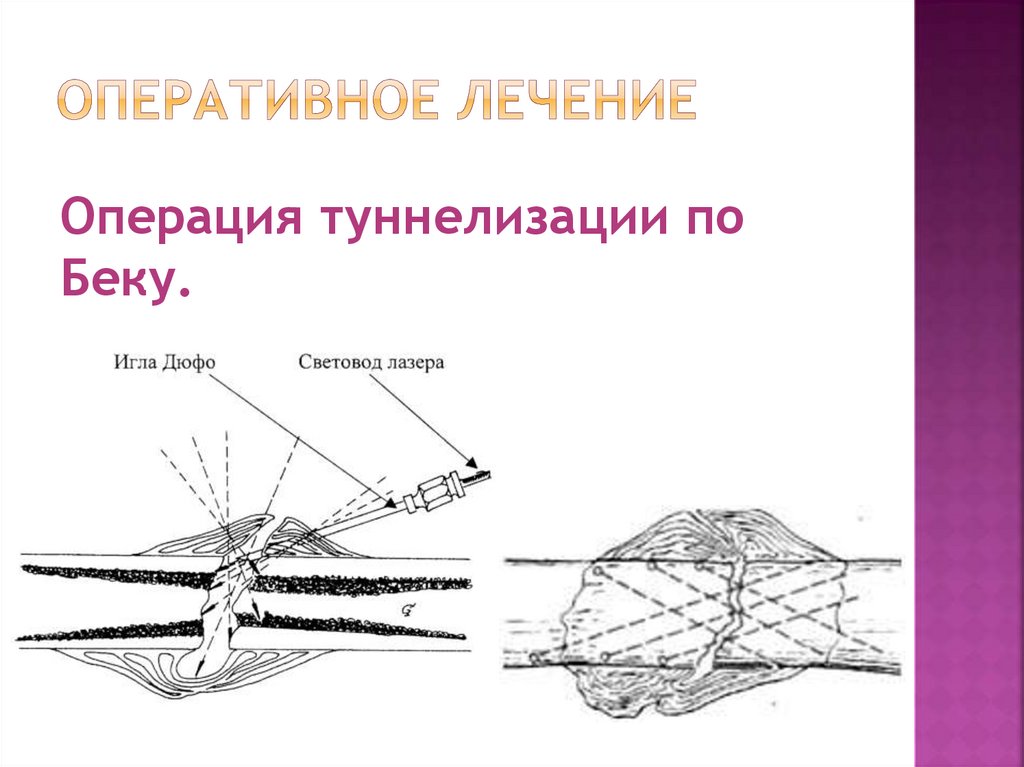 Оперативное лечение