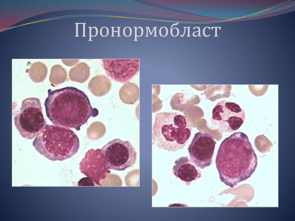 Пронормобласт