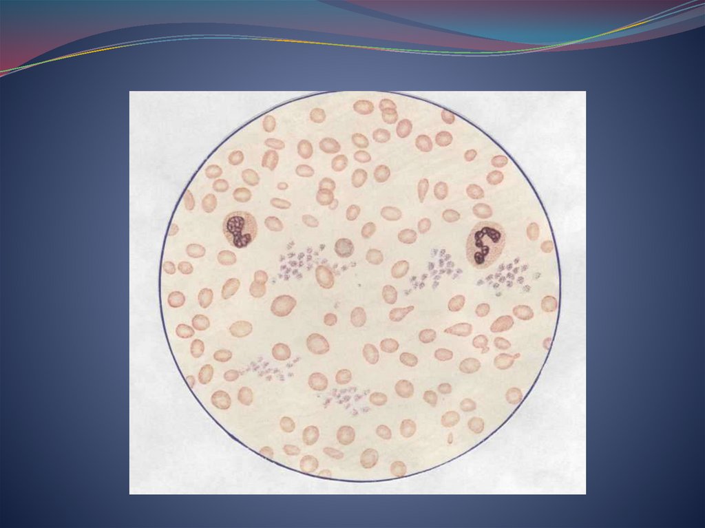 Пойкилоциты