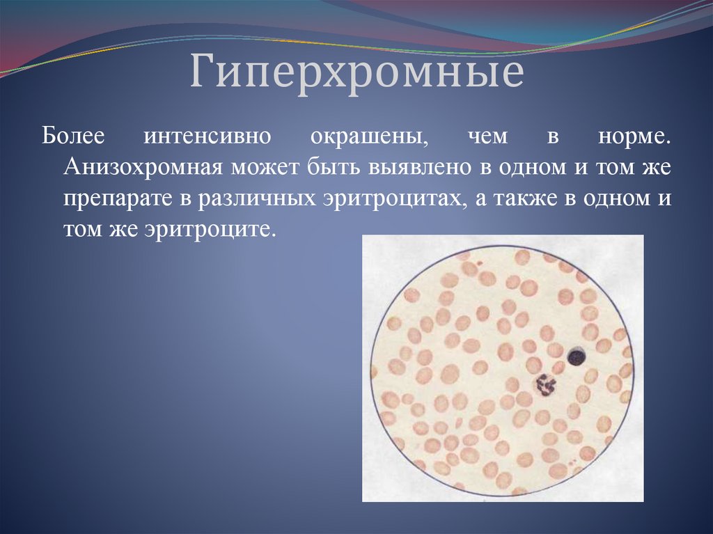 Гипохромные