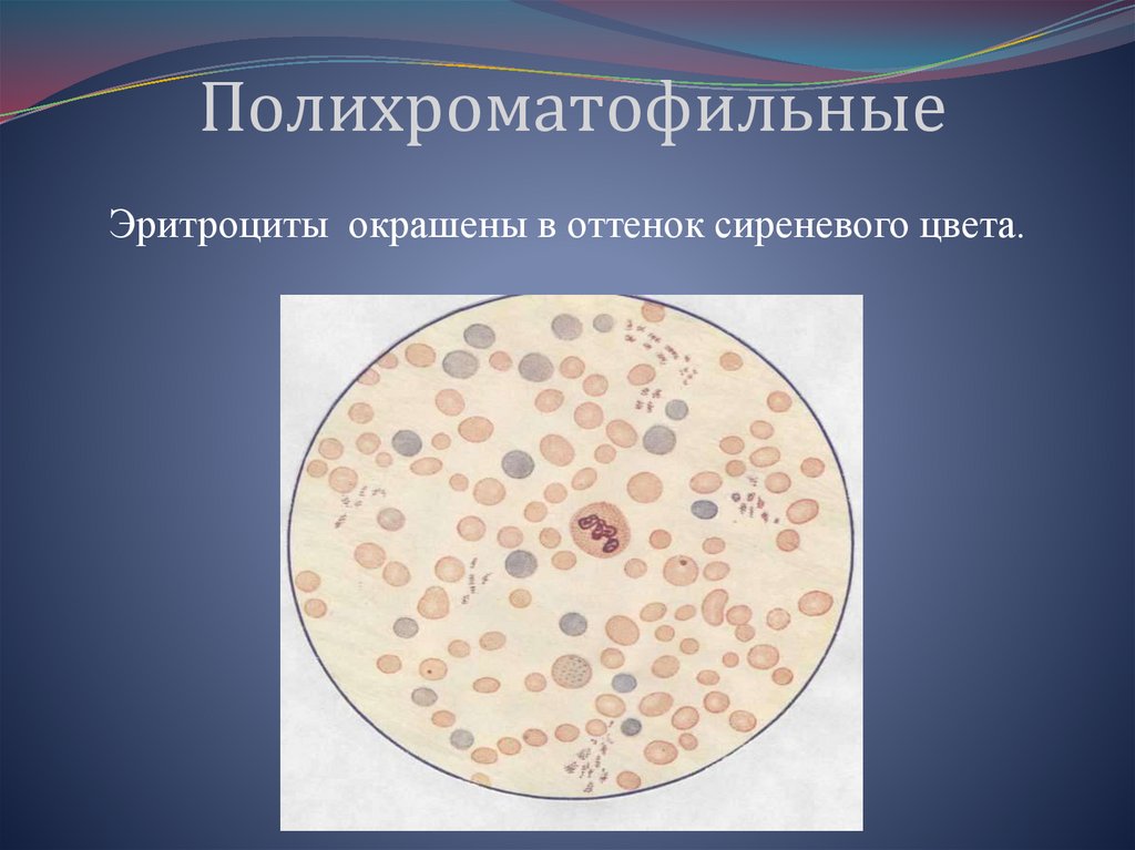 Гиперхромные