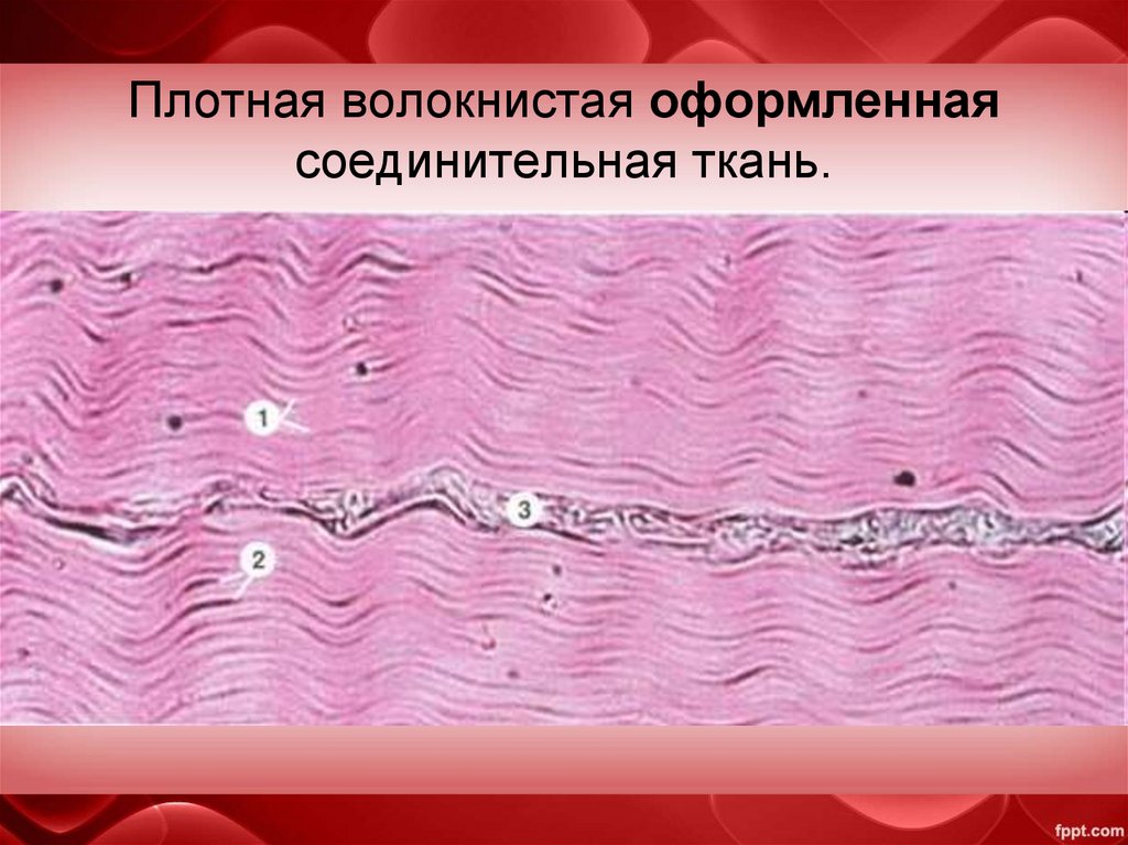 Плотная волокнистая оформленная соединительная ткань.