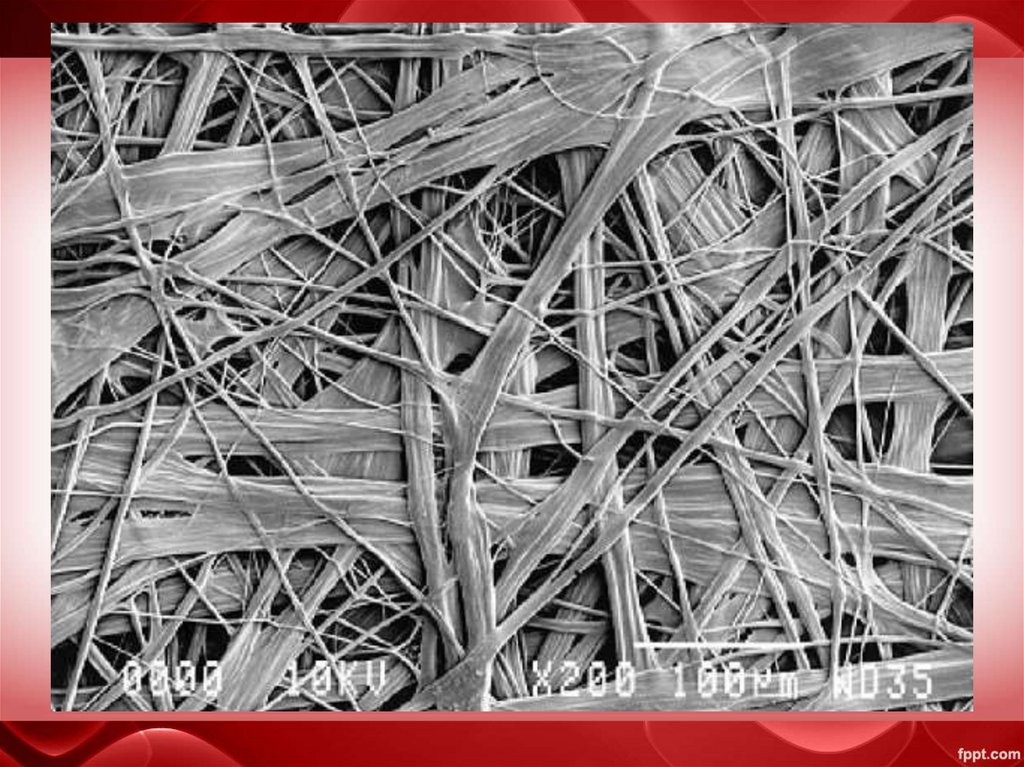 Плотная волокнистая неоформленная соединительная ткань.