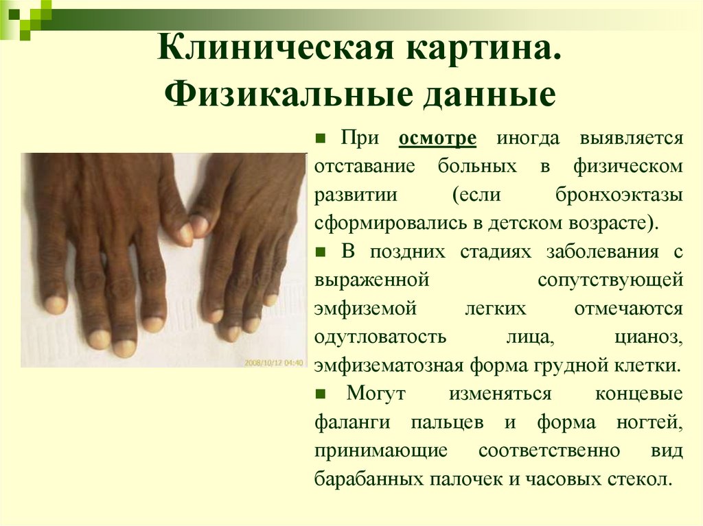 Клиническая картина. Физикальные данные