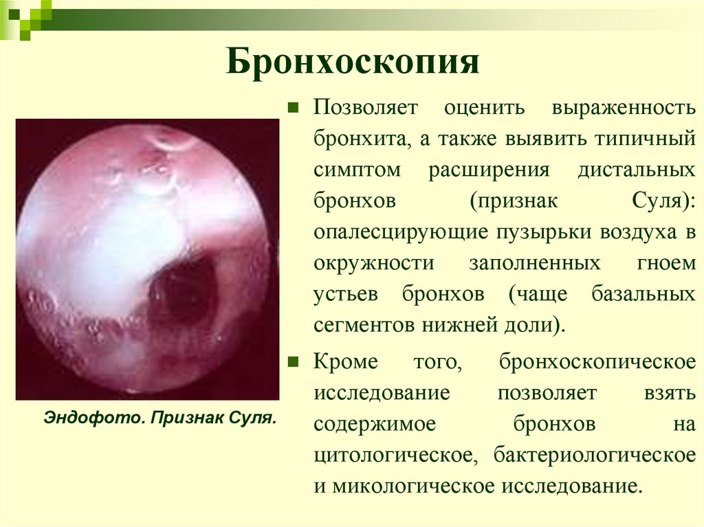 Бронхоскопия