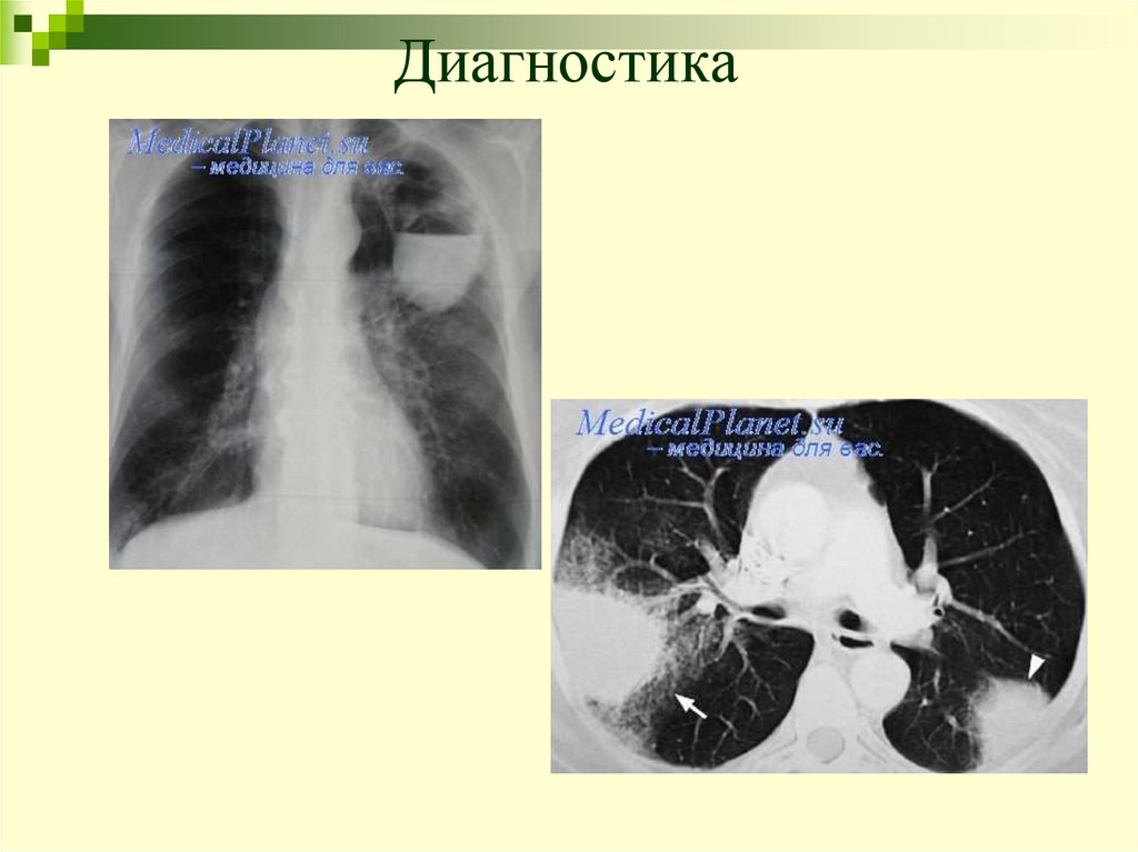 Диагностика