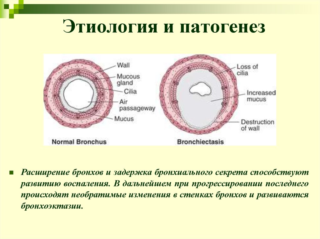 Этиология и патогенез